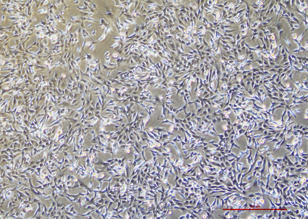 人肺癌细胞Calu-1(STR鉴定) | EnkiLife恩玑生命