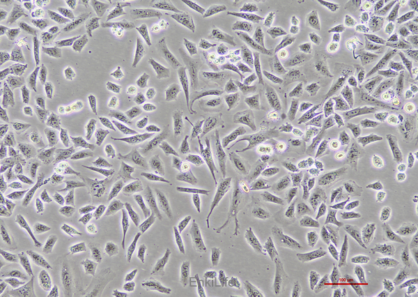 人肺癌细胞NCI-H1703 [H1703](STR鉴定) | EnkiLife恩玑生命