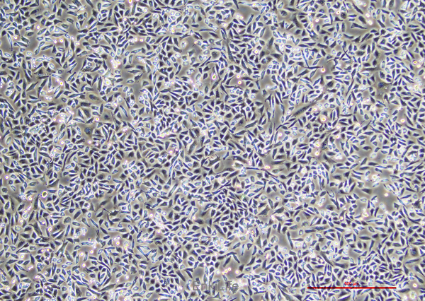 人肺癌细胞NCI-H1703 [H1703](STR鉴定) | EnkiLife恩玑生命