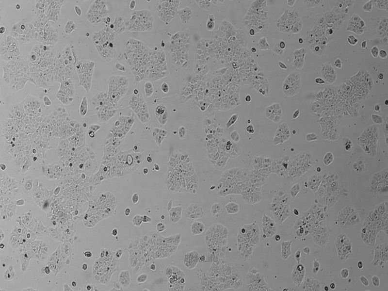 人肺癌细胞NCI-H1944(STR鉴定) | EnkiLife恩玑生命