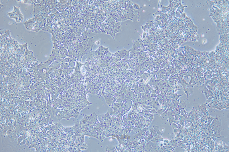 人肺癌细胞NCI-H2170(STR鉴定) | EnkiLife恩玑生命