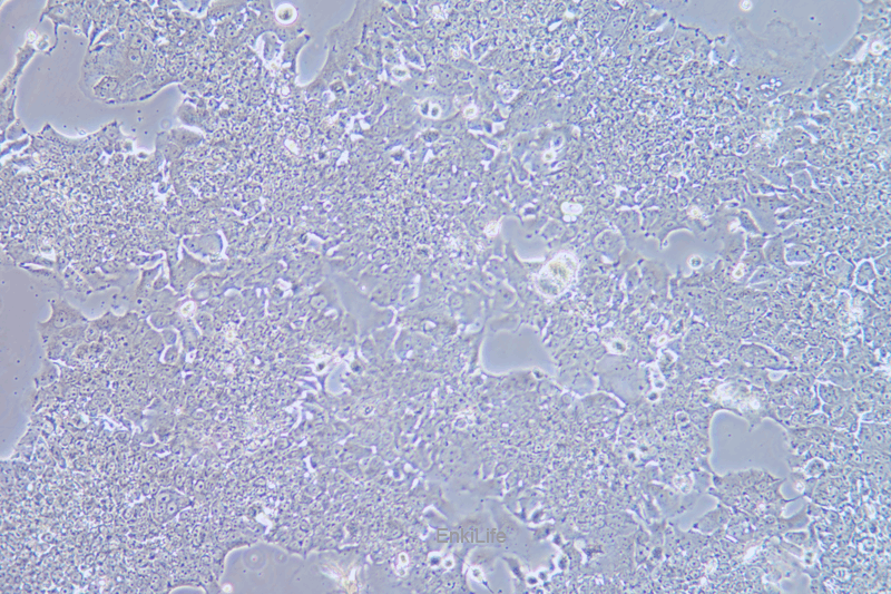 人肺癌细胞NCI-H2170(STR鉴定) | EnkiLife恩玑生命