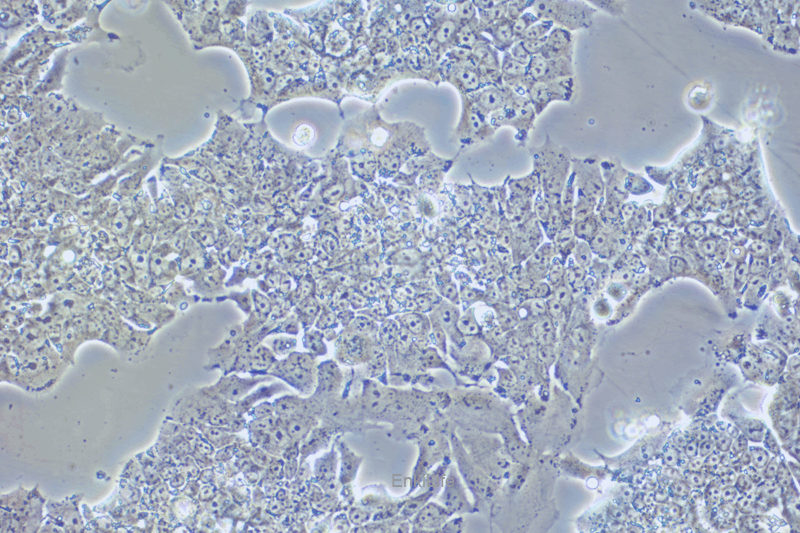 人肺癌细胞NCI-H2170(STR鉴定) | EnkiLife恩玑生命
