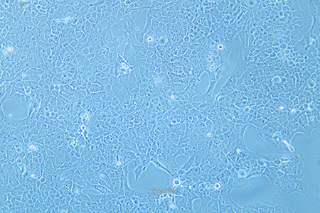 人肺癌细胞NCI-H2228(STR鉴定) | EnkiLife恩玑生命