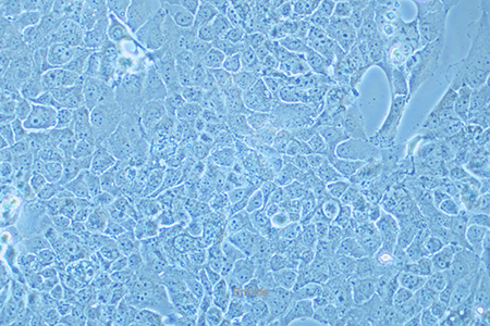 人肺癌细胞NCI-H2228(STR鉴定) | EnkiLife恩玑生命