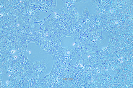 人肺癌细胞NCI-H2228(STR鉴定) | EnkiLife恩玑生命