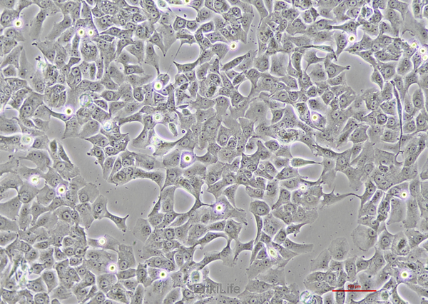 人肺腺癌细胞HCC4006(STR鉴定) | EnkiLife恩玑生命