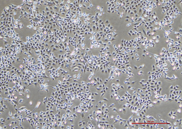 人肺腺癌细胞NCI-H1975(STR鉴定) | EnkiLife恩玑生命