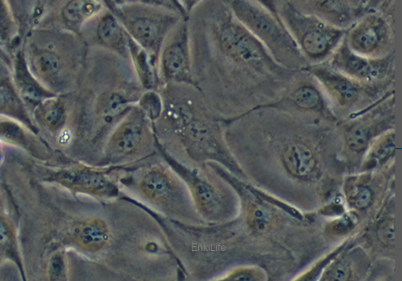 人肺腺癌细胞NCI-H3255（STR鉴定） | EnkiLife恩玑生命