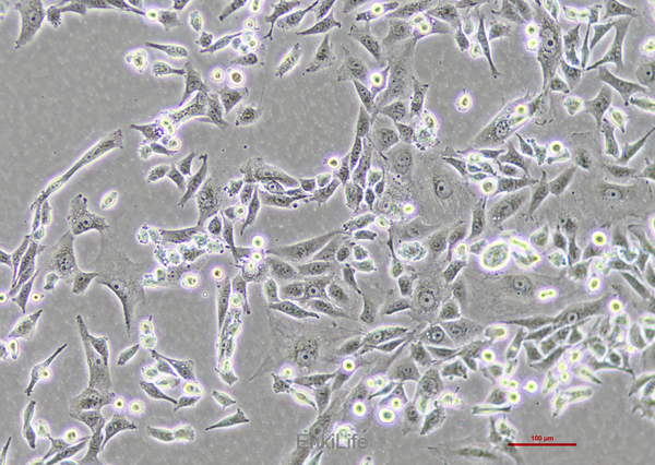 人肝癌细胞sk-hep-1(STR鉴定) | EnkiLife恩玑生命