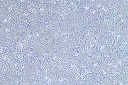 人骨肉瘤细胞143B(STR鉴定) | EnkiLife恩玑生命