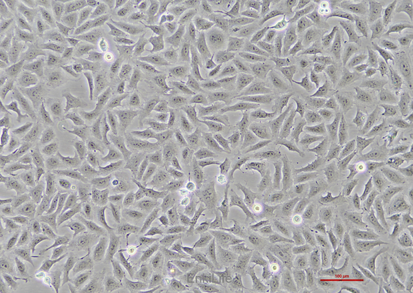 人骨肉瘤细胞HOS(STR鉴定) | EnkiLife恩玑生命