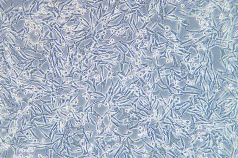 人黑素瘤细胞WM-115(STR鉴定) | EnkiLife恩玑生命