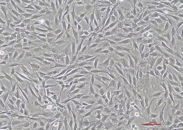 人甲状腺鳞癌细胞SW579(STR鉴定) | EnkiLife恩玑生命