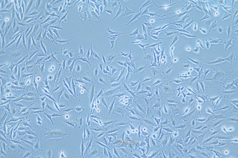 人胶质瘤细胞稳定表达荧光素酶LN-229+LUC(STR鉴定) | EnkiLife恩玑生命