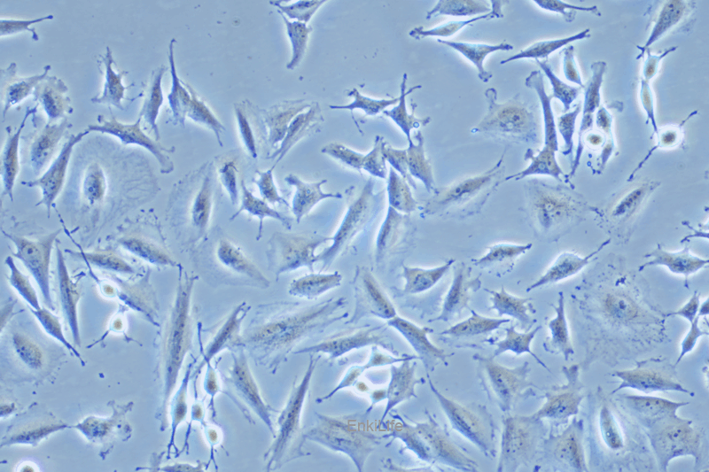 人胶质瘤细胞稳定表达荧光素酶LN-229+LUC(STR鉴定) | EnkiLife恩玑生命