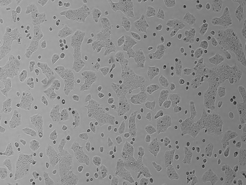 人结肠腺癌细胞SW1116(STR鉴定) | EnkiLife恩玑生命