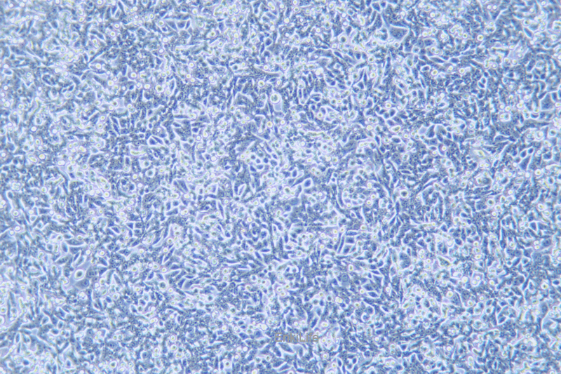 人结直肠腺癌细胞荧光素酶标记SW620-LUC(STR鉴定) | EnkiLife恩玑生命