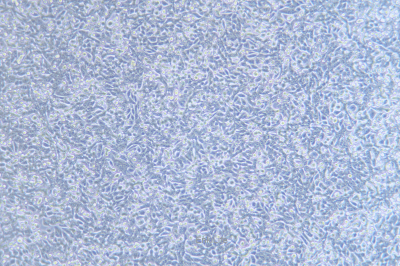 人结直肠腺癌细胞荧光素酶标记SW620-LUC(STR鉴定) | EnkiLife恩玑生命