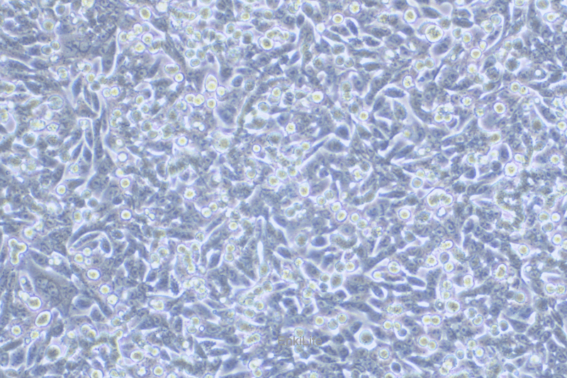 人结直肠腺癌细胞荧光素酶标记SW620-LUC(STR鉴定) | EnkiLife恩玑生命