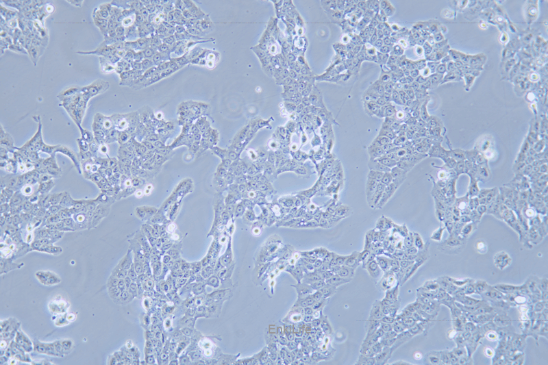 人口腔鳞状癌细胞WSU-HN30(STR鉴定) | EnkiLife恩玑生命