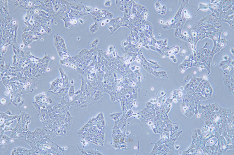人口腔鳞状癌细胞WSU-HN30(STR鉴定) | EnkiLife恩玑生命
