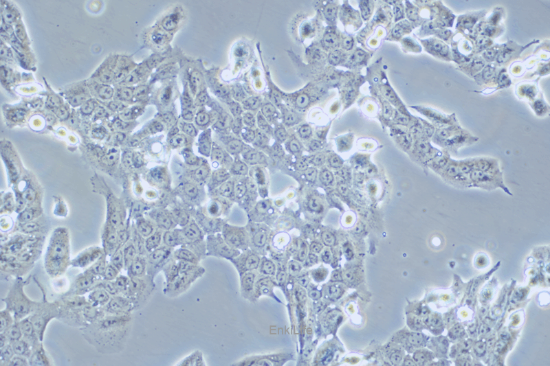 人口腔鳞状癌细胞WSU-HN30(STR鉴定) | EnkiLife恩玑生命