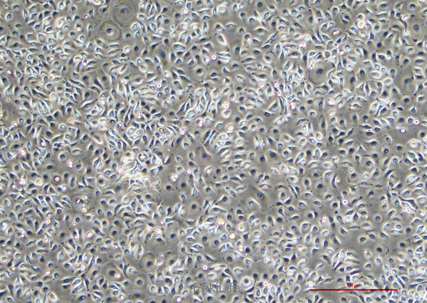 人口腔鳞状肿瘤细胞HSC-2(STR鉴定) | EnkiLife恩玑生命