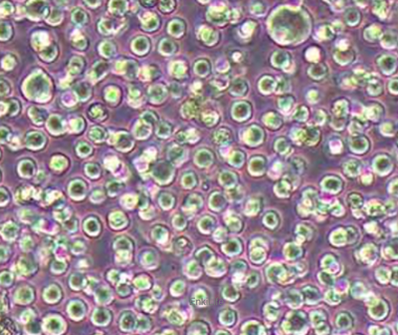 人弥漫大B淋巴瘤细胞HBL-1 | EnkiLife恩玑生命