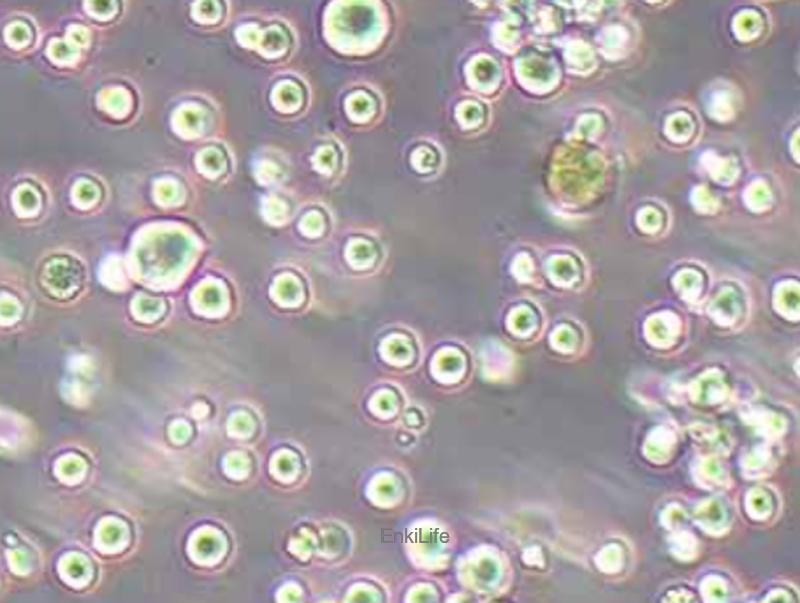 人弥漫大B淋巴瘤细胞HBL-1 | EnkiLife恩玑生命