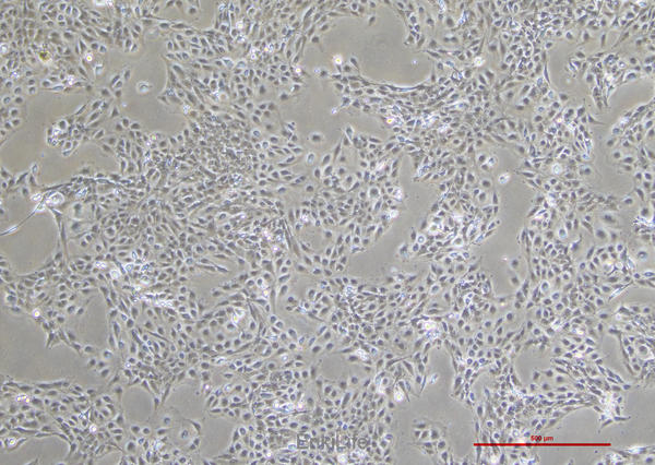 人膜间皮细胞MET-5A(STR鉴定) | EnkiLife恩玑生命