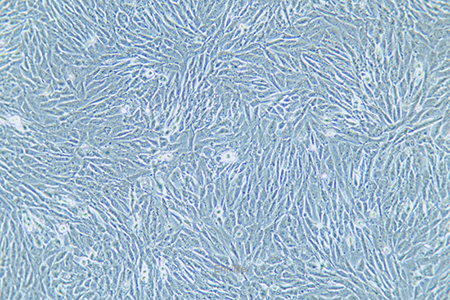 人脑胶质瘤细胞HS683(STR鉴定) | EnkiLife恩玑生命
