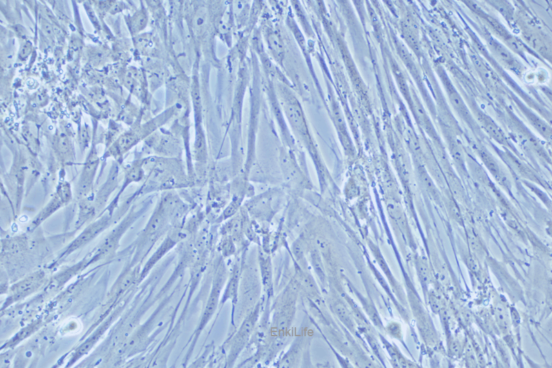 人胚肺成纤维细胞MRC-5(STR鉴定) | EnkiLife恩玑生命