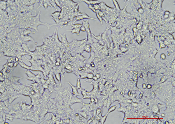 人前列腺癌细胞22RV1(STR鉴定) | EnkiLife恩玑生命