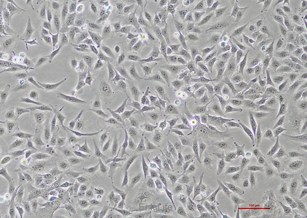 人乳头状甲状腺癌细胞TPC-1(STR鉴定) | EnkiLife恩玑生命