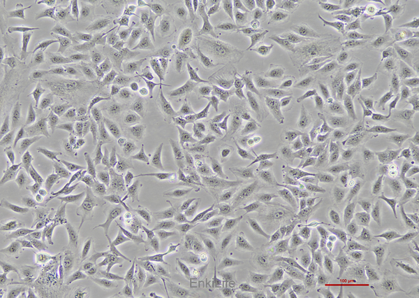 人乳头状甲状腺癌细胞TPC-1(STR鉴定) | EnkiLife恩玑生命
