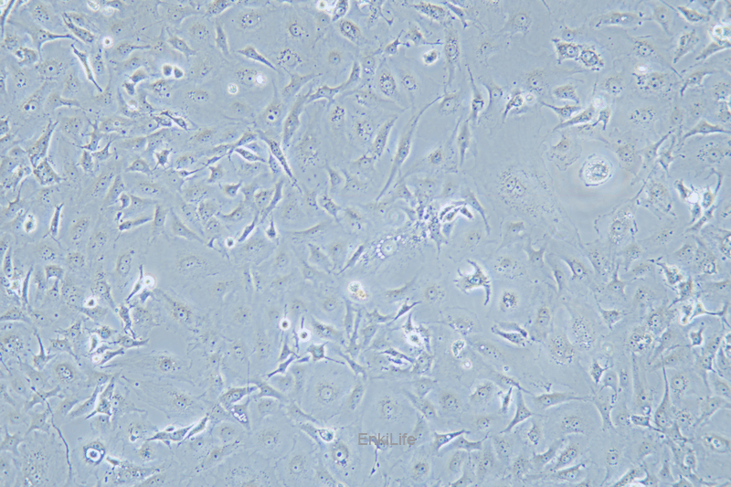 人乳腺癌细胞MDA-MB-157(STR鉴定) | EnkiLife恩玑生命
