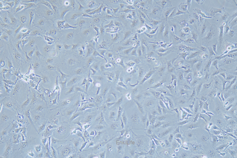 人乳腺癌细胞MDA-MB-157(STR鉴定) | EnkiLife恩玑生命