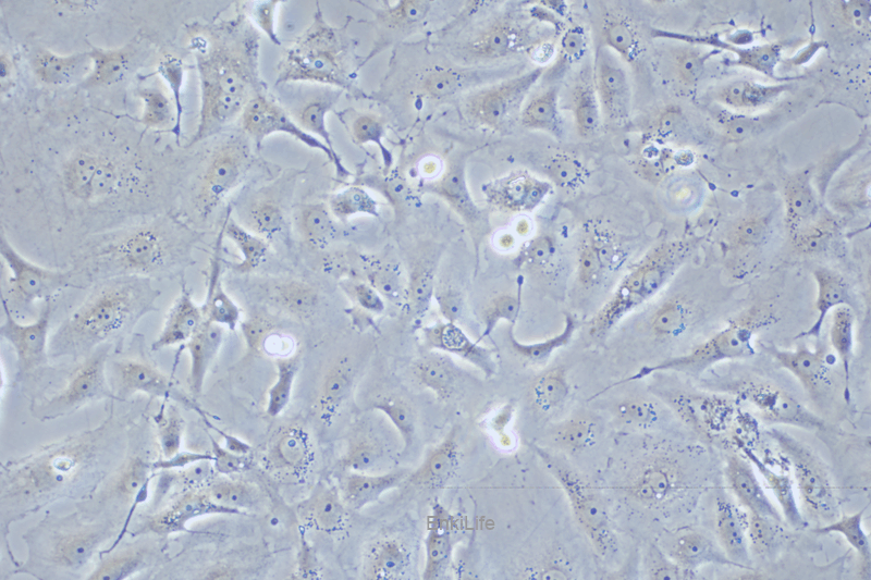 人乳腺癌细胞MDA-MB-157(STR鉴定) | EnkiLife恩玑生命