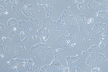 人乳腺癌细胞MDA-MB-361(STR鉴定) | EnkiLife恩玑生命