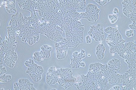 人乳腺癌细胞MDA-MB-361(STR鉴定) | EnkiLife恩玑生命