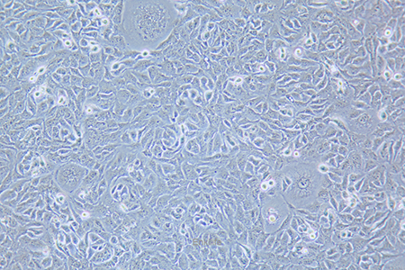 人乳腺鳞状癌细胞HCC1806(STR鉴定) | EnkiLife恩玑生命