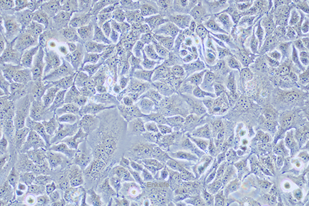 人乳腺鳞状癌细胞HCC1806(STR鉴定) | EnkiLife恩玑生命