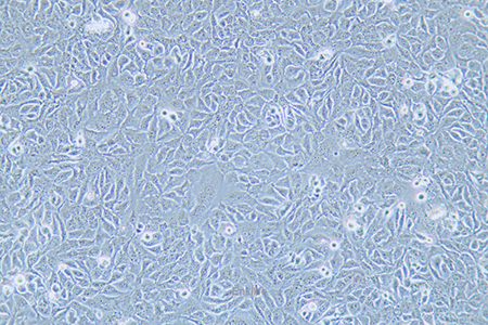 人乳腺鳞状癌细胞HCC1806(STR鉴定) | EnkiLife恩玑生命