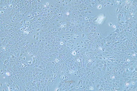 人食管癌细胞Eca-109(STR鉴定) | EnkiLife恩玑生命