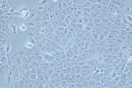 人食管癌细胞Eca-109(STR鉴定) | EnkiLife恩玑生命