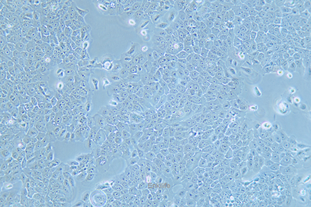 人食管癌细胞Eca-109(STR鉴定) | EnkiLife恩玑生命