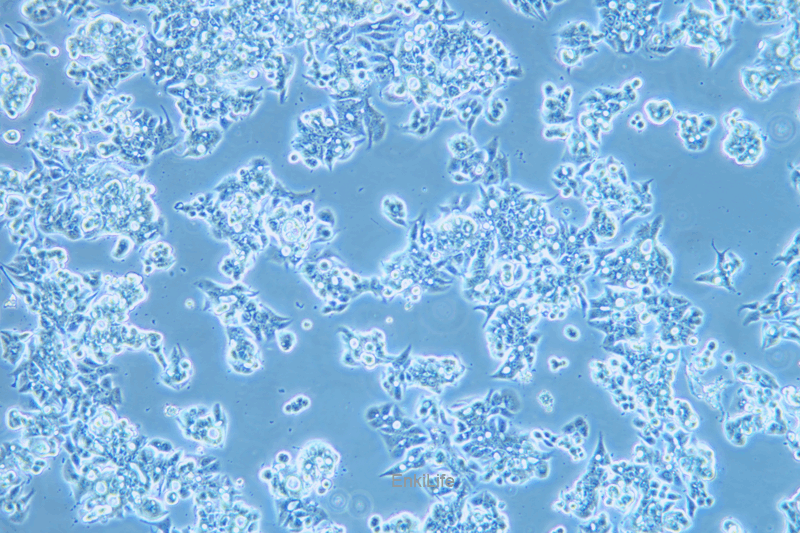 人食管癌细胞OE19(STR鉴定) | EnkiLife恩玑生命