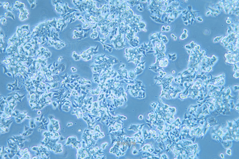 人食管癌细胞OE19(STR鉴定) | EnkiLife恩玑生命