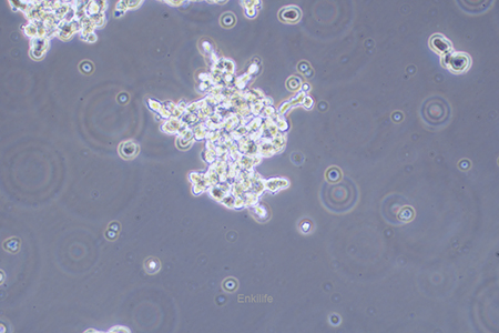 人视网膜神经胶质瘤细胞WERI-RB-1(STR鉴定) | EnkiLife恩玑生命